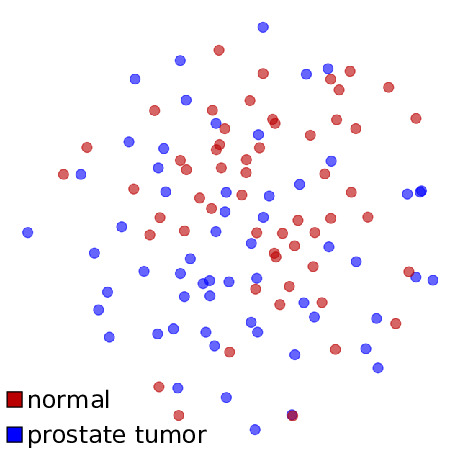 Prostate - no scoring
